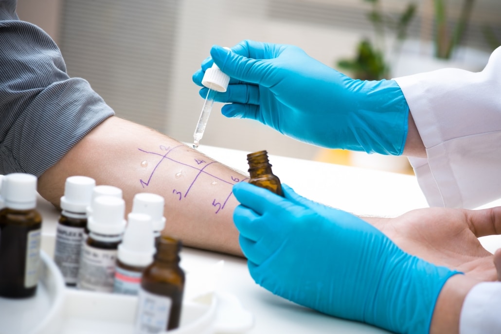How to Treat Allergic Reactions
